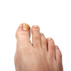 Ingrown Toenails