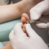 Toenail Care
